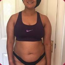 Core Contouring Before